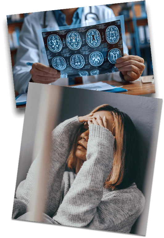 Image of brain scan and a woman holding her head